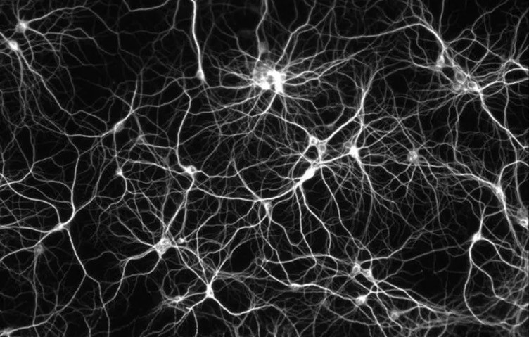 A neural network with nodes and branches connecting other nodes